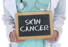 skin cancer
