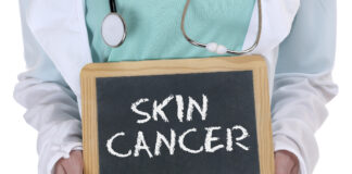 skin cancer