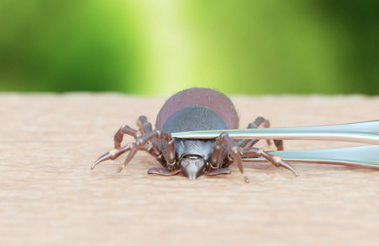 Tick Season Is Almost Here: Know The Bug That Bit You